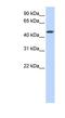 Sulfotransferase family cytosolic 2B member 1 antibody, NBP1-54828, Novus Biologicals, Western Blot image 