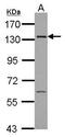 Interferon Induced With Helicase C Domain 1 antibody, PA5-27848, Invitrogen Antibodies, Western Blot image 
