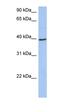 Acyl-CoA Dehydrogenase Medium Chain antibody, orb329690, Biorbyt, Western Blot image 