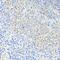 CCCTC-Binding Factor antibody, GTX65930, GeneTex, Immunohistochemistry paraffin image 