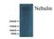 Nebulin antibody, MA1069, Boster Biological Technology, Western Blot image 