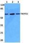 Ro60, Y RNA Binding Protein antibody, A03428, Boster Biological Technology, Western Blot image 
