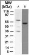 Tumor Protein P73 antibody, orb87971, Biorbyt, Western Blot image 