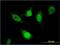Splicing Regulatory Glutamic Acid And Lysine Rich Protein 1 antibody, MA5-23061, Invitrogen Antibodies, Immunofluorescence image 