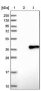 Fc Fragment Of IgG Receptor And Transporter antibody, PA5-53283, Invitrogen Antibodies, Western Blot image 