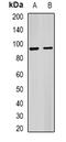 Interleukin 1 Receptor Accessory Protein antibody, orb340898, Biorbyt, Western Blot image 