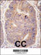 Taspase 1 antibody, 56-979, ProSci, Immunohistochemistry paraffin image 