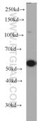 Tetratricopeptide Repeat Domain 31 antibody, 21693-1-AP, Proteintech Group, Western Blot image 