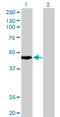 Keratin 34 antibody, LS-C197593, Lifespan Biosciences, Western Blot image 
