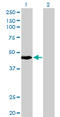 Keratin, type I cuticular Ha4 antibody, LS-C197593, Lifespan Biosciences, Western Blot image 