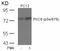 Protein Kinase C Theta antibody, P01293, Boster Biological Technology, Western Blot image 