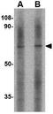 Leucine Rich Repeat LGI Family Member 2 antibody, GTX85408, GeneTex, Western Blot image 