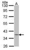 Left-Right Determination Factor 2 antibody, TA308258, Origene, Western Blot image 