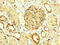 NPHS1 Adhesion Molecule, Nephrin antibody, CSB-PA015988LA01HU, Cusabio, Immunohistochemistry paraffin image 