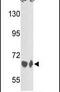 Complement Factor B antibody, PA5-14244, Invitrogen Antibodies, Western Blot image 