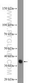 General Transcription Factor IIIC Subunit 6 antibody, 26382-1-AP, Proteintech Group, Western Blot image 