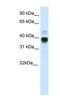 Homeobox A11 antibody, NBP1-80228, Novus Biologicals, Western Blot image 