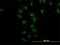 Nuclear Receptor Subfamily 4 Group A Member 2 antibody, H00004929-M10, Novus Biologicals, Immunocytochemistry image 