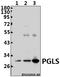 6-Phosphogluconolactonase antibody, A02553, Boster Biological Technology, Western Blot image 