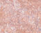 Jumonji Domain Containing 8 antibody, 5387, ProSci, Immunohistochemistry paraffin image 