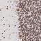 Cyclin Dependent Kinase Inhibitor 1C antibody, NBP1-89917, Novus Biologicals, Immunohistochemistry frozen image 