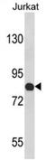 Cartilage Oligomeric Matrix Protein antibody, AP17228PU-N, Origene, Western Blot image 