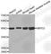 N-lysine methyltransferase SMYD2 antibody, A2327, ABclonal Technology, Western Blot image 