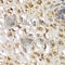 Serum/Glucocorticoid Regulated Kinase 1 antibody, A1025, ABclonal Technology, Immunohistochemistry paraffin image 