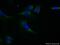 Protein Phosphatase 1 Catalytic Subunit Beta antibody, 10140-2-AP, Proteintech Group, Immunofluorescence image 