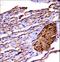 Mitogen-Activated Protein Kinase Kinase Kinase 2 antibody, LS-C164453, Lifespan Biosciences, Immunohistochemistry paraffin image 