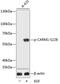 Coactivator Associated Arginine Methyltransferase 1 antibody, GTX53931, GeneTex, Western Blot image 