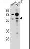 Tripartite Motif Containing 62 antibody, LS-C160206, Lifespan Biosciences, Western Blot image 