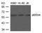 Docking Protein 1 antibody, GTX50588, GeneTex, Western Blot image 