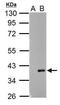 Actin Related Protein 2/3 Complex Subunit 1A antibody, GTX118303, GeneTex, Western Blot image 