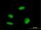 KH-Type Splicing Regulatory Protein antibody, H00008570-M03, Novus Biologicals, Immunofluorescence image 