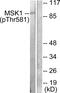 Ribosomal Protein S6 Kinase A5 antibody, PA5-38370, Invitrogen Antibodies, Western Blot image 