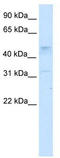 Transcription Factor AP-2 Gamma antibody, TA345651, Origene, Western Blot image 
