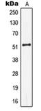 Keratin 13 antibody, orb214168, Biorbyt, Western Blot image 
