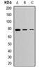 CLPTM1 Regulator Of GABA Type A Receptor Forward Trafficking antibody, abx225114, Abbexa, Western Blot image 