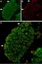 Transient Receptor Potential Cation Channel Subfamily V Member 2 antibody, PA5-77318, Invitrogen Antibodies, Immunohistochemistry paraffin image 