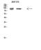 Autophagy Related 9A antibody, STJ98589, St John