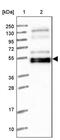 WAPL Cohesin Release Factor antibody, PA5-58149, Invitrogen Antibodies, Western Blot image 