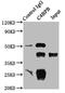 Complement Component 4 Binding Protein Beta antibody, LS-C375362, Lifespan Biosciences, Immunoprecipitation image 