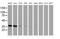 Glyoxylate And Hydroxypyruvate Reductase antibody, MA5-25337, Invitrogen Antibodies, Western Blot image 