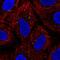 Keratin 222 antibody, HPA054586, Atlas Antibodies, Immunofluorescence image 