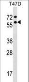 General Transcription Factor IIF Subunit 1 antibody, LS-C159798, Lifespan Biosciences, Western Blot image 