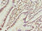 Ras Related GTP Binding C antibody, LS-C676433, Lifespan Biosciences, Immunohistochemistry paraffin image 