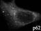 Sequestosome 1 antibody, ab91526, Abcam, Immunofluorescence image 