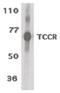 Interleukin 27 Receptor Subunit Alpha antibody, orb86771, Biorbyt, Western Blot image 