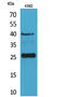 Killer Cell Lectin Like Receptor B1 antibody, STJ96641, St John